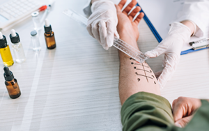 Alergia: tipos, sintomas e quando procurar um médico