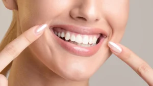 3 fatos sobre o clareamento dental Central de Consultas | Clínica Popular