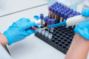 Infeccoes sexualmente transmissiveis por bacterias Central de Consultas | Clínica Popular