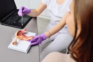 Mioma uterino Tipos sintomas e tratamentos Central de Consultas | Clínica Popular