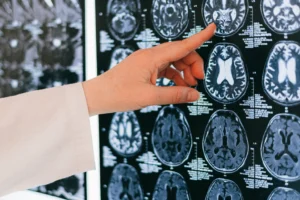 BLOG CEREBRO Central de Consultas | Clínica Popular
