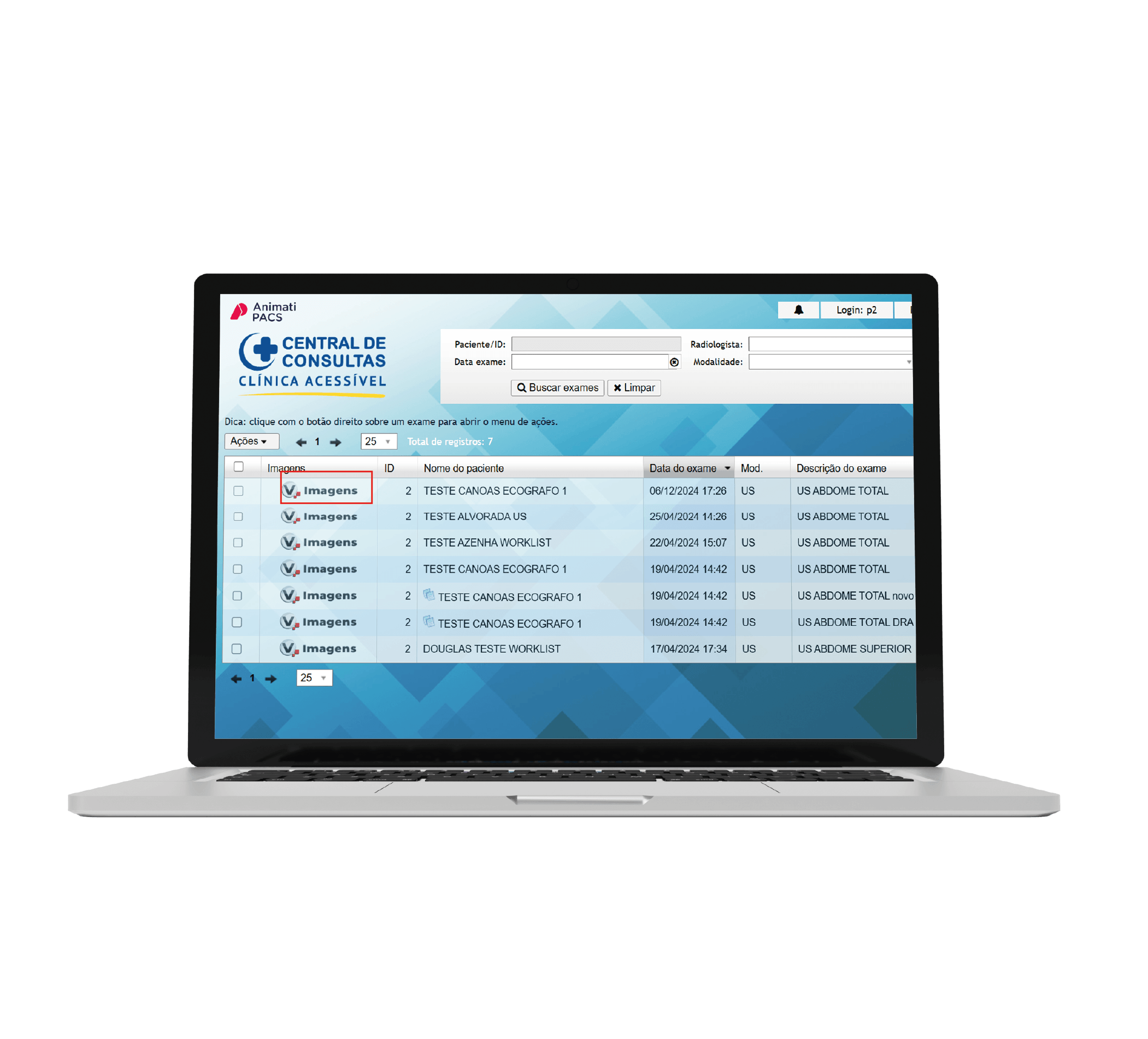 Tela de um laptop mostrando um sistema de consultas clínicas, com uma lista de exames e detalhes como nome do paciente, data do exame e descrição.