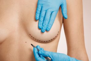 woman marked out cosmetic surgery Central de Consultas | Clínica Popular