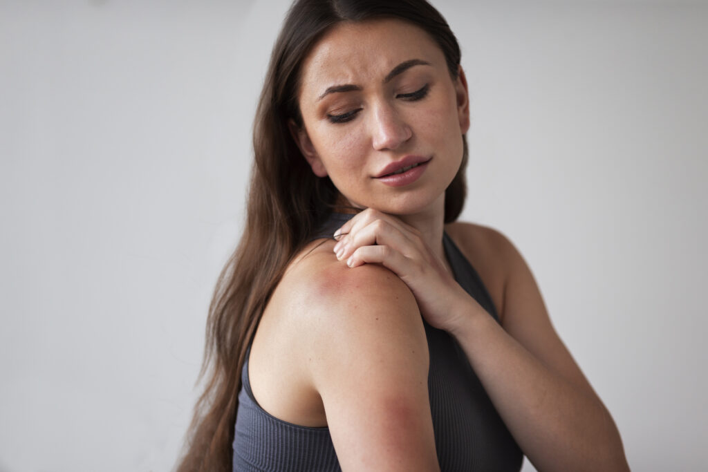 Hanseníase: sinais na pele e por que o diagnóstico precoce importa 1 woman suffering from rash Central de Consultas | Clínica Popular