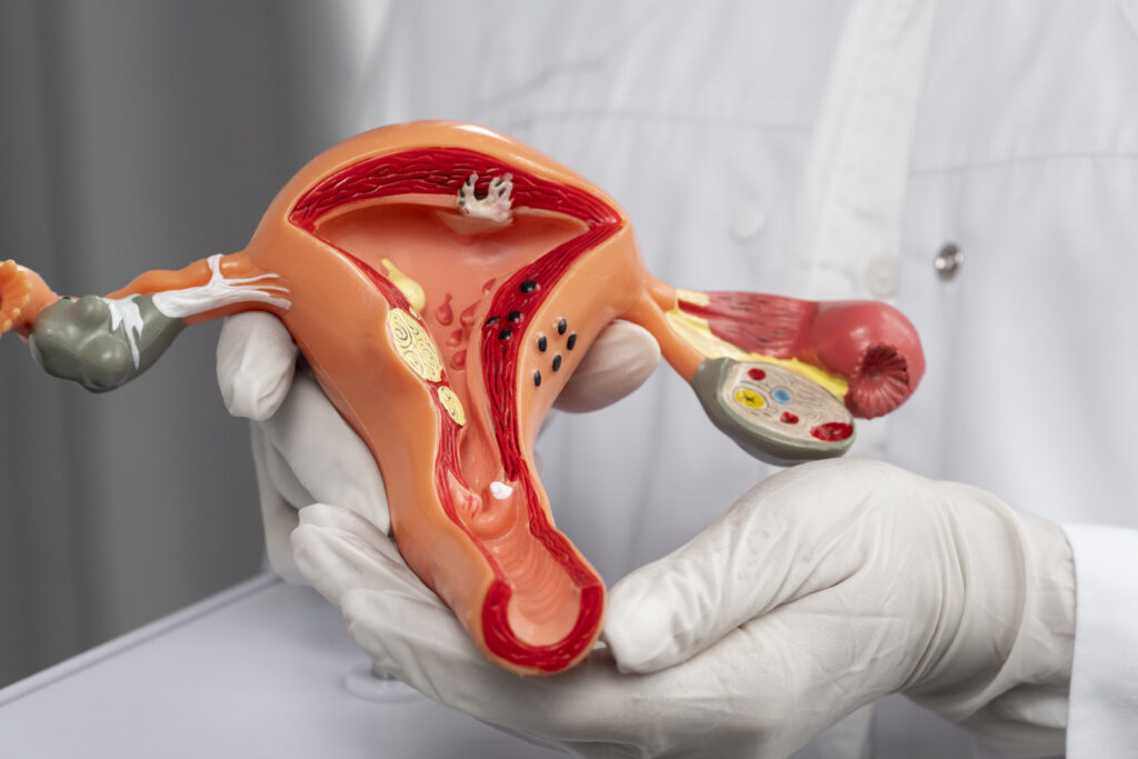 Cisto no Ovário: Quando é Benigno e Quando Precisa Acompanhamento 1 doctor holding anatomic model high angle Central de Consultas | Clínica Popular