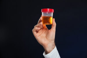 close up male s hand holding container with urine sample Central de Consultas | Clínica Popular