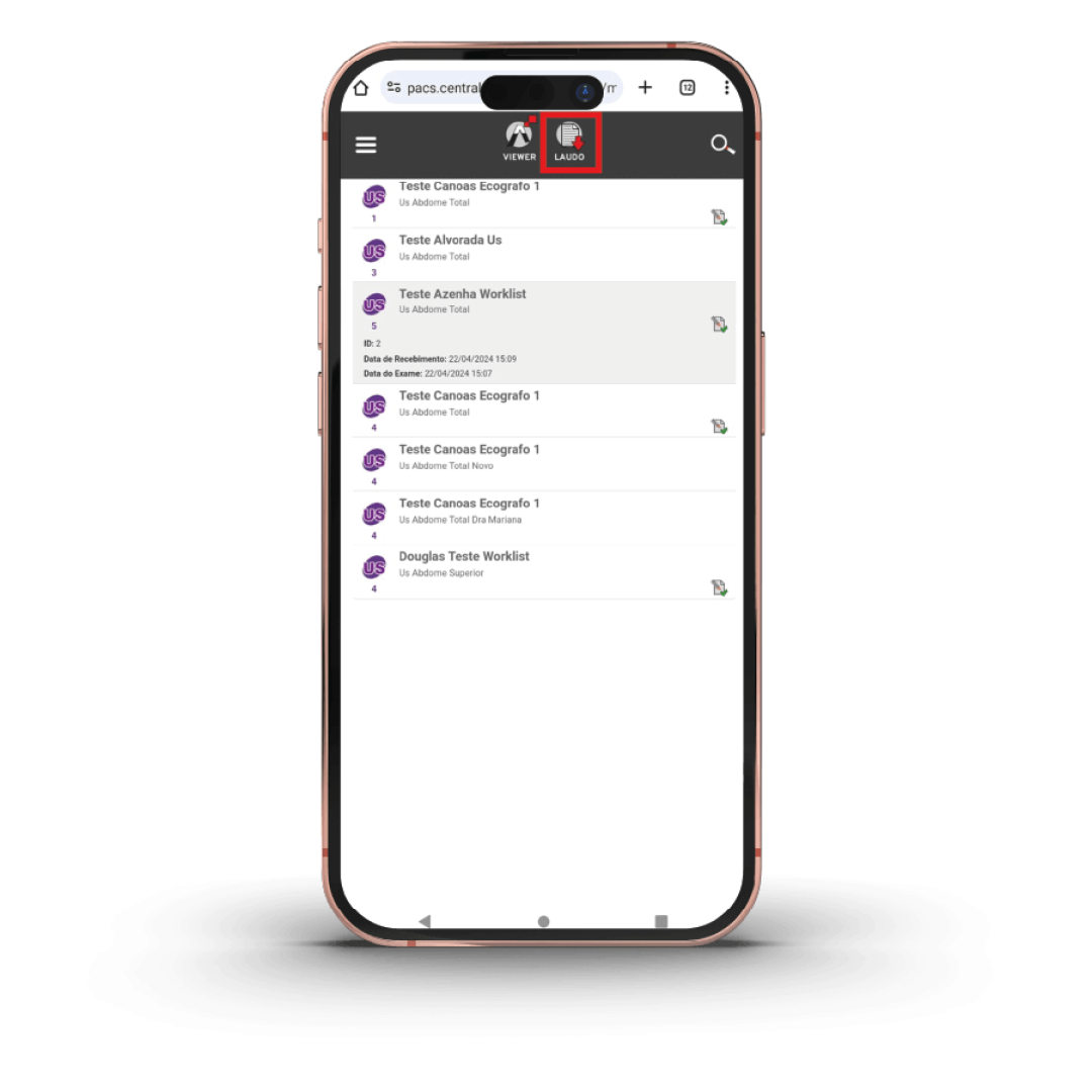 5º Download do laudo no telefone