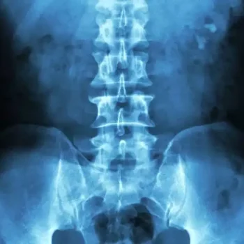 interpretacao-de-raio-x-abdomen-radiografia