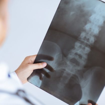 close up of male doctor holding x-ray or roentgen image